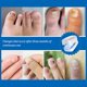 thumbnail image 4 of Portable Nail Fungals Treatments Light Durable Effective Nail Fungals Remover for Damageds Nail, 4 of 5