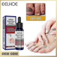 thumbnail image 1 of Nail Treatment Nail Care Manicure And Pedicure Nourishing And Cleansing Removal Of Grey N, 1 of 4