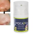 thumbnail image 4 of Oil Control Mud Mask, Oil Control Water Oil Balance Moisturizing Pore Cleansing Clay Mask For Travel For Home ANGGREK AI1412, 4 of 8