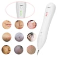 thumbnail image 3 of Pluma profesional para eliminación de lunares en el hogar, eliminador de manchas oscuras y pecas, instrumento de belleza para la piel, 3 of 12