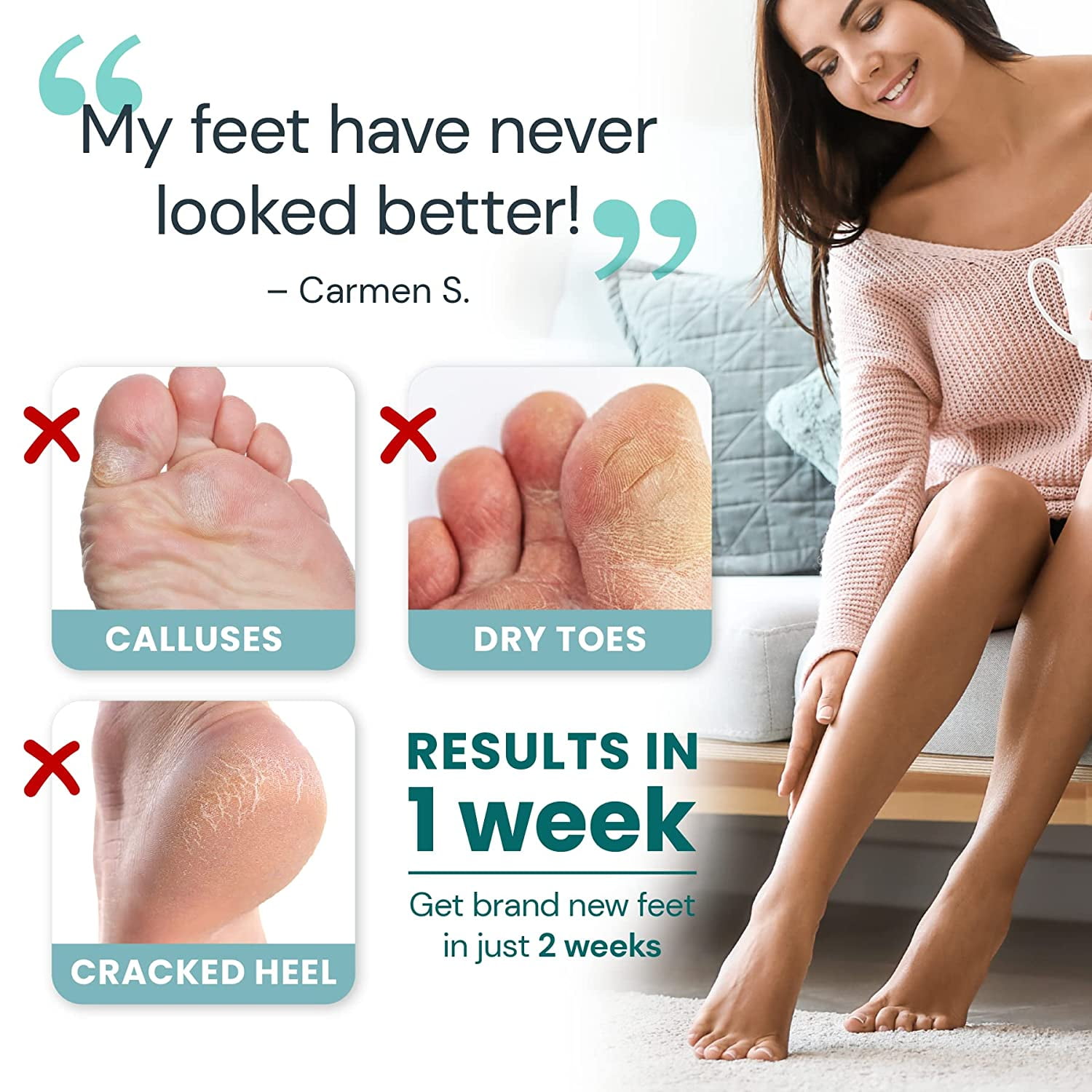 Foot Peel Exfoliating Mask Deep Skin Exfoliation For Dry Cracked Feet Calluses And Rough Heels Walmart Com