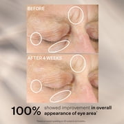 StriVectin Intensive Eye Concentrate for Wrinkles Plus, 1 fl oz