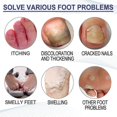 thumbnail image 2 of 10pcs Foot Soak For Toenail Repair, Athletes Foot, Softens Calluses, Soothes Sore Tired Feet, Foot Scent Foot Clean Healthy Ingredients, 2 of 5