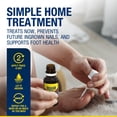 thumbnail image 3 of Kit de tratamiento para uñas encarnadas URIEL UPGRADE de 11 ml, 3 of 6