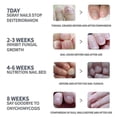 thumbnail image 4 of 2025 Fungal Nail Treatment Patch, Nail Repair Patches Fungal Nail Repair Treatment- Repair Onychomycosis Fungal Nail Patches, 4 of 5