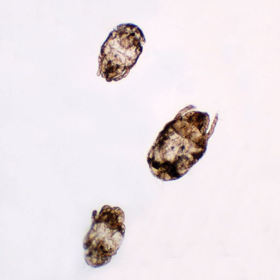 Dust Mites, W.M., Individual Microscope Slide