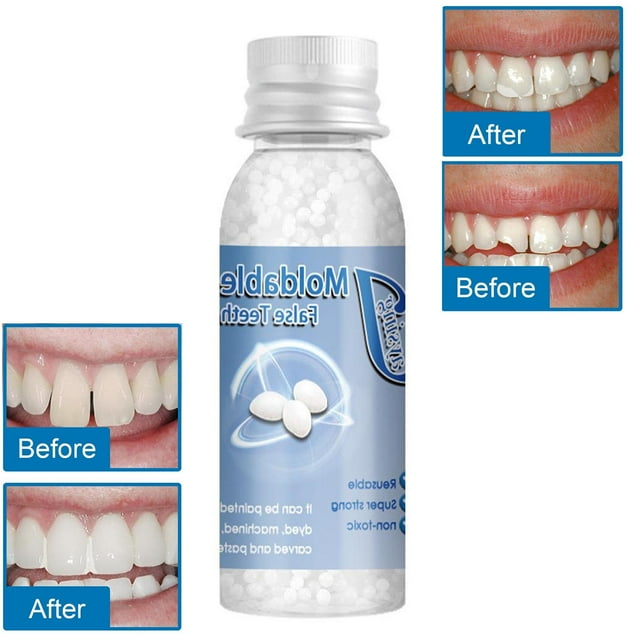 Herramienta de Reparación de Dientes Temporales shamjiam Adhesivo para Dentadura Relleno Térmico 10Ml Perlas de Reparación de Dientes
