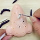 thumbnail image 2 of Juguete para Apretar Espinillas, Alivia El Estrés Y La Ansiedad Atención Exprimir El Acné Juguetes Sensoriales para Adultos Niños con Pinza Juguete De Descompresión para El Autismo XianweiShao 8390615120364, 2 of 4