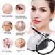 thumbnail image 1 of Dispositivo De Belleza De La Piel, Equipo De Belleza Con Ajuste De 3 Engranajes Eficaz Para Aumentar La Capacidad Antioxidante Para Aumentar La Actividad Celular, 1 of 7