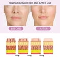thumbnail image 2 of Esencia de ampolla EELHOE 7 ampollas x 2ml Pro-colágeno Lifting Ampolla Essence Firm Elástico Plumping Smoothing Reduce Arrugas Dealy Aging EELHOE Esencia de ampolla, 2 of 7