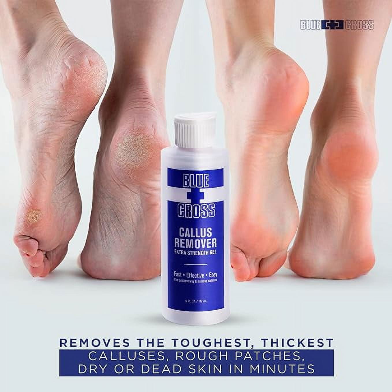 Blue Cross Professional Extra Strength Callus Remover Gel for Feet or Heel, at Home Manicure/Pedicure Results, 6 fl oz