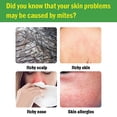 thumbnail image 3 of 6Pcs Bags Dust Mites Killer Mite Eliminator Nature For Bed Sheet Sofa, 3 of 5