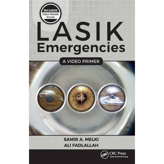LASIK Emergencies: A Video Primer, (Paperback)