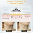 thumbnail image 3 of Red Light Therapy for Face, Facial Massager for Face and Neck, 7-in-1 Led Facial Sculptor, 3 of 7