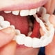 thumbnail image 5 of Dientes Postizos Temporales NikouMX 6 Piezas Carillas Dentales Snapin, 5 of 8