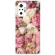 thumbnail image 3 of Funda para Xiaomi Redmi Note 10 Funda Note 10S Silicona Suave TPU Fundas Cover para Redmi Note 10 Pro Versión Global Teléfono Bumper, 3 of 5