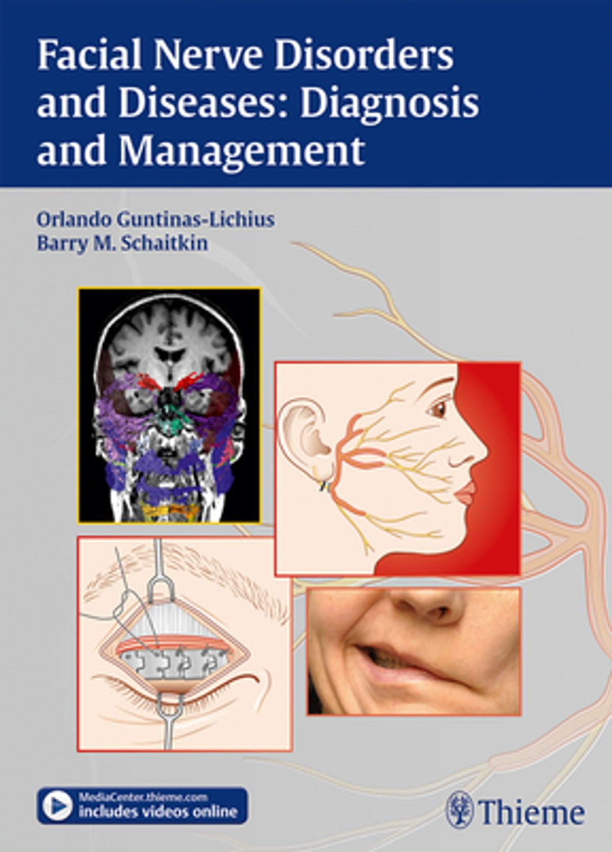 Facial Nerve Disorders and Diseases: Diagnosis and Management - eBook