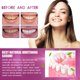thumbnail image 5 of 10ml Oral Clean Teeth Whiten Essence Oral Bacteria Inhibiting Convenient Use For After Eating Teeth Cleansing, 5 of 5