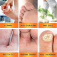 thumbnail image 2 of 3-in-1 Bee Venom Foot Spray for Nail Fungus, Athlete's Foot & Tinea Pedis,Natural Antifungal Treatment,Repairs Cracked Nails & Discoloration, 2 of 4