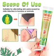 thumbnail image 4 of Además de ácaros ungüento adulto antipruriginoso tópico piojos ungüento piel eczema dermatitis parche, 4 of 4