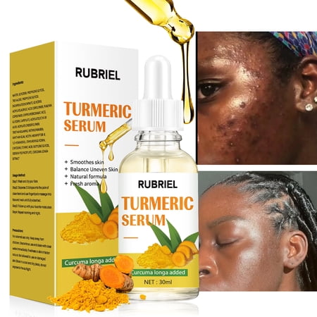 Turmeric Serum for Dark Spots, Turmeric Dark Spot Corrector Serum for Face & Body, Turmeric Facial Repair Serum Cleanses Skin, Fights Acne - Pure Turmeric Oil Skincare for All Skin Types