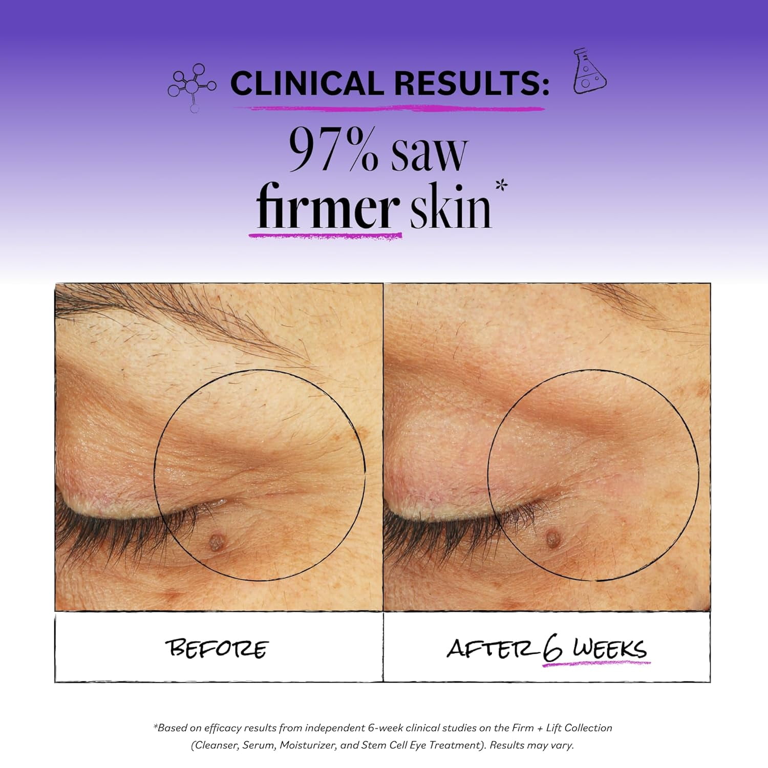 (Pack Of 3) Derma E Eye Lift Firming DMAE 0.5 Oz