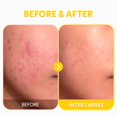 thumbnail image 3 of TIRTIR &ndash; S&eacute;rum Vitamina C24 30 ml &ndash; serum facial con 24% vitamina C pura, triple col&aacute;geno y Cica-7 &ndash; luminosidad y apariencia de manchas &ndash;, 3 of 9