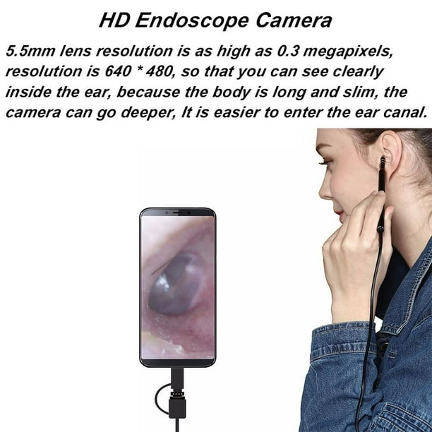 Otoscope Oreille Endoscope Caméra Oreille Visuelle Intelligente HD