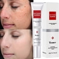 thumbnail image 2 of Crema blanqueadora para pecas, elimina eficazmente el Melasma, manchas oscuras, melanina, hidratante, ilumina y suaviza la piel del rostro, 20g Fivean unisex, 2 of 2