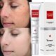 thumbnail image 2 of Crema Blanqueadora para Pecas Fivean eelhoe 20g Unisex, 2 of 2