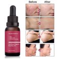 thumbnail image 1 of 10ml/botella de aceite de semilla de rosa mosqueta aceite de rosa mosqueta prensado en frío humectante para la piel seca de la cara líneas finas y cicatrices de acné, 1 of 5
