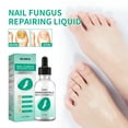 thumbnail image 1 of Kerassentials Toenail Fungus Oil Kerasentials Nail , Kerassentials Healthy Skin,Kerasentials Nail 60ml Buy 2 Save 10%, 1 of 4