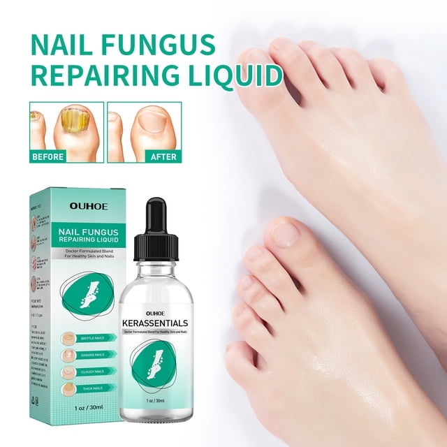 Kerassentials Toenail Fungus Oil Kerasentials Nail , Kerassentials Healthy Skin,Kerasentials Nail 60ml Buy 2 Save 10%