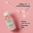 thumbnail image 2 of Loción secante Mario Badescu de Drying Duo, 30 ml y 60 parches, 2 of 9