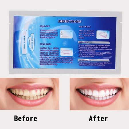 28Pcs Teeth Whitening Strips Professional Teeth Bleaching Gel Strip Effective Dental Care Kit Set,Effects Whitestrips Dental Teeth Whitening