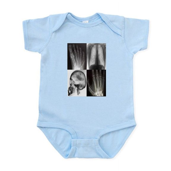 CafePress - Bkgrnd 1C Body Suit - Baby Light Bodysuit, Size Newborn - 24 Months