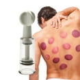 thumbnail image 3 of Rotating Handle Vacuum Suction Cupping Family Therapy Cupping Cups (2.5cm), 3 of 7