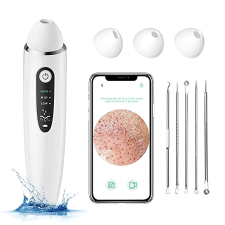 Blackhead Remover Pore Vacuum, 1080P WiFi Visible Facial Pore Ceaner ...