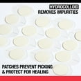 Neutrogena Stubborn Acne Hydrocolloid Acne Treatment Patch, 24 ct