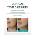 thumbnail image 3 of Face Mask REJURAN Perfect V Tighter c-PDRN 4pcs Anti-Aging, 3 of 8