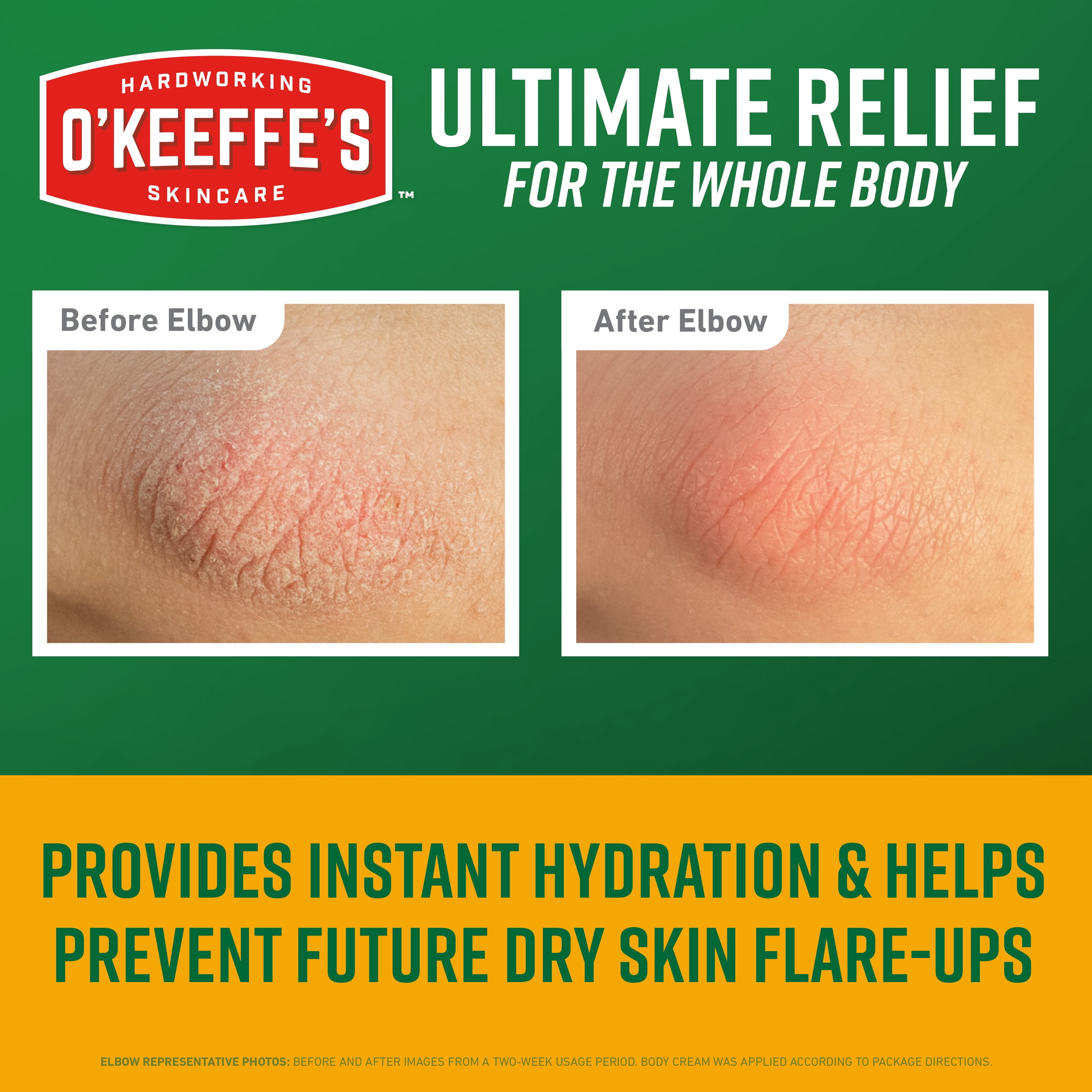 O’Keeffe’s Skin Repair Body Cream, Ultimate Relief, 48 Hour Moisture, Unscented, 7oz Tube