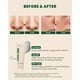 thumbnail image 3 of Espuma limpiadora K-SECRET SEOUL 1988 Pine Cica 1% + Probiotics 150 ml, 3 of 6