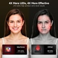 thumbnail image 6 of Morfone Red Light Therapy for Face, 4 Modes Led Face Mask Light Therapy with Remote, Portable Light Therapy Mask for Skin Care at Home, Travel (Black), 6 of 9