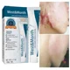 thumbnail image 4 of Crema de eliminación de cicatrices a base de hierbas, Gel quirúrgico para quemar cicatrices, cesárea, crema de tratamiento de estrías, cuidado suave de la piel, 4 of 5