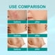 thumbnail image 5 of Clearance Sale! 20ml Scar Remover Spray Pimples Stretch Marks Scar Gel Smoothing Body Skin Care Promote Cell Regeneration Spray (Buy 2 get 1 free), 5 of 9