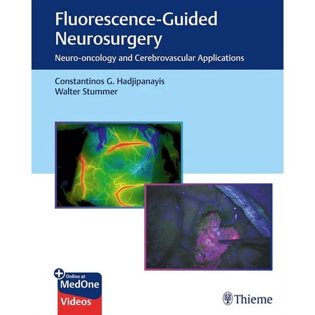 UPC: 9781626237148 | Fluorescence-Guided Neurosurgery: Neuro-Oncology and Cerebrovascular Applications (Hardcover)