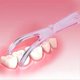 thumbnail image 3 of Tooth Flossers Adults Flosser Reusable Refillable Floss Holder Floss Picks Tooth Floss Holder, 3 of 4