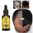 thumbnail image 3 of Hair Growth Essence Hair Loss Scalp Treatments Ginger Ginseng Raise Dense Hai, 3 of 4