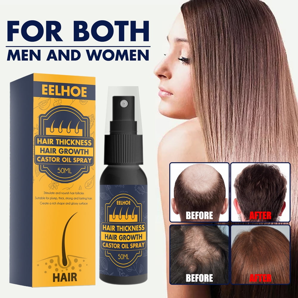 Moisturizing Hair Follicle Castor Oil Hair Growth Hair Anti-Hair Loss 50Ml Hair  Growth Serums Oil Hose Essence Hair Loss Treatment Hair Care Repair Damage  