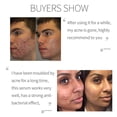 thumbnail image 4 of PANSLY Azelaic Acid 10% Facial Essence Facial Relaxation Lifting Firming Improvement of Wrinkles, 4 of 5
